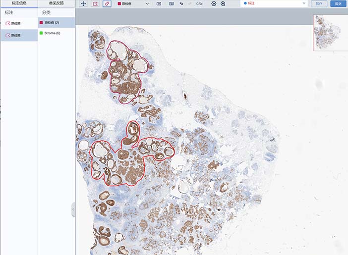 标注系统轮播图_4