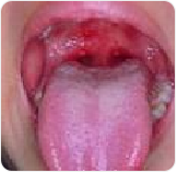 img2