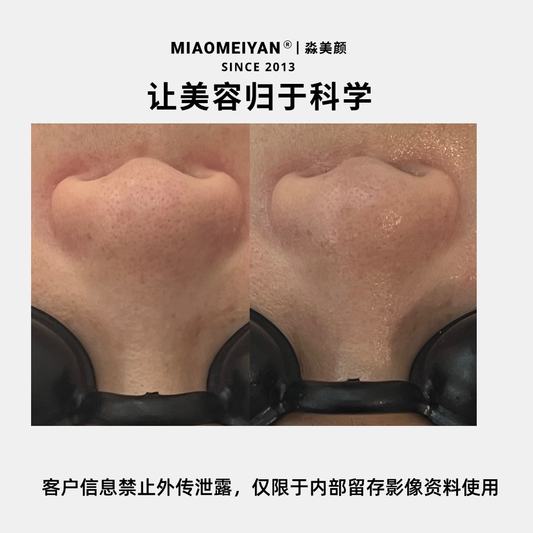 案例3