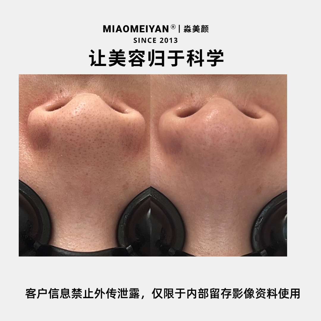 案例2