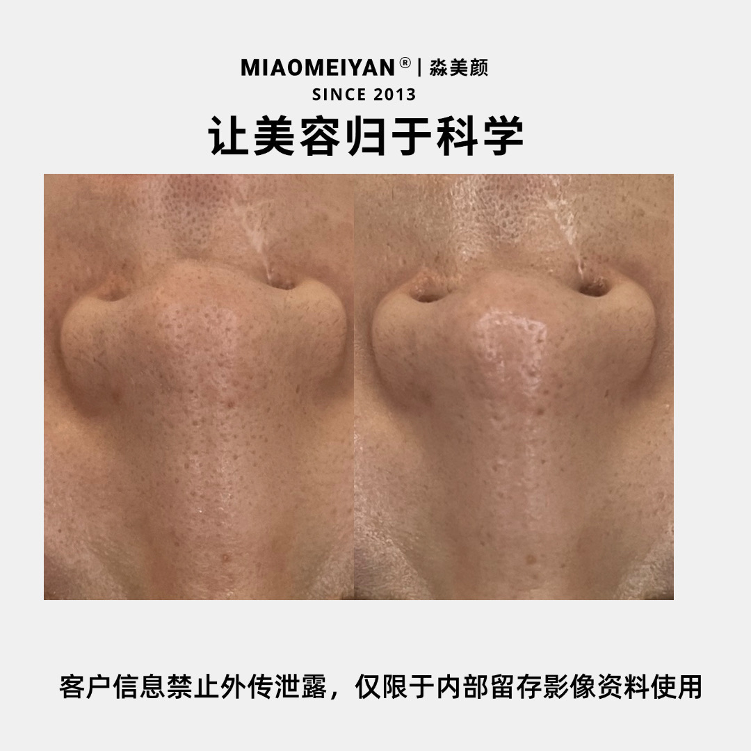 案例1