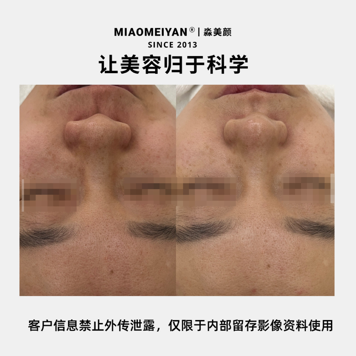 案例1