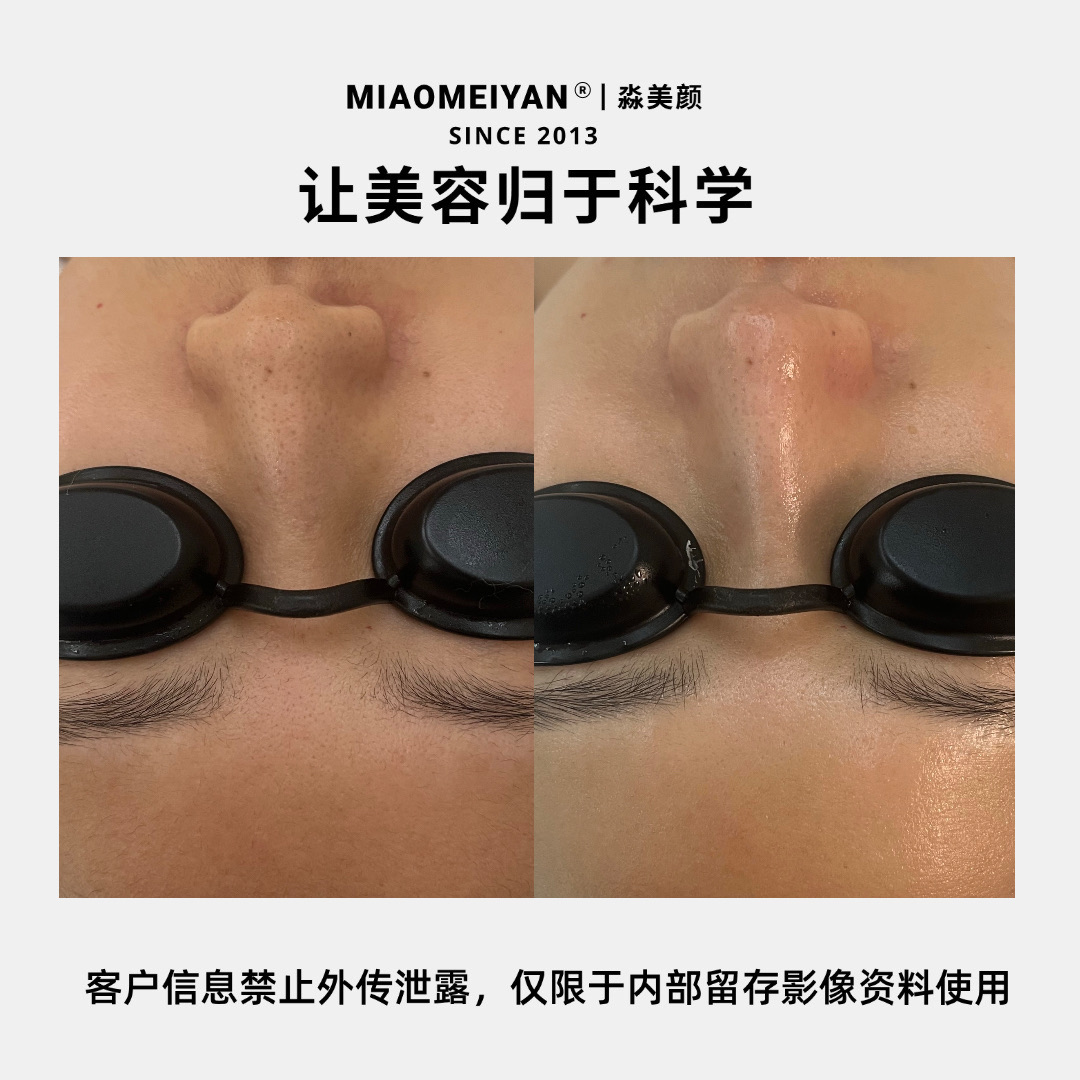 案例2
