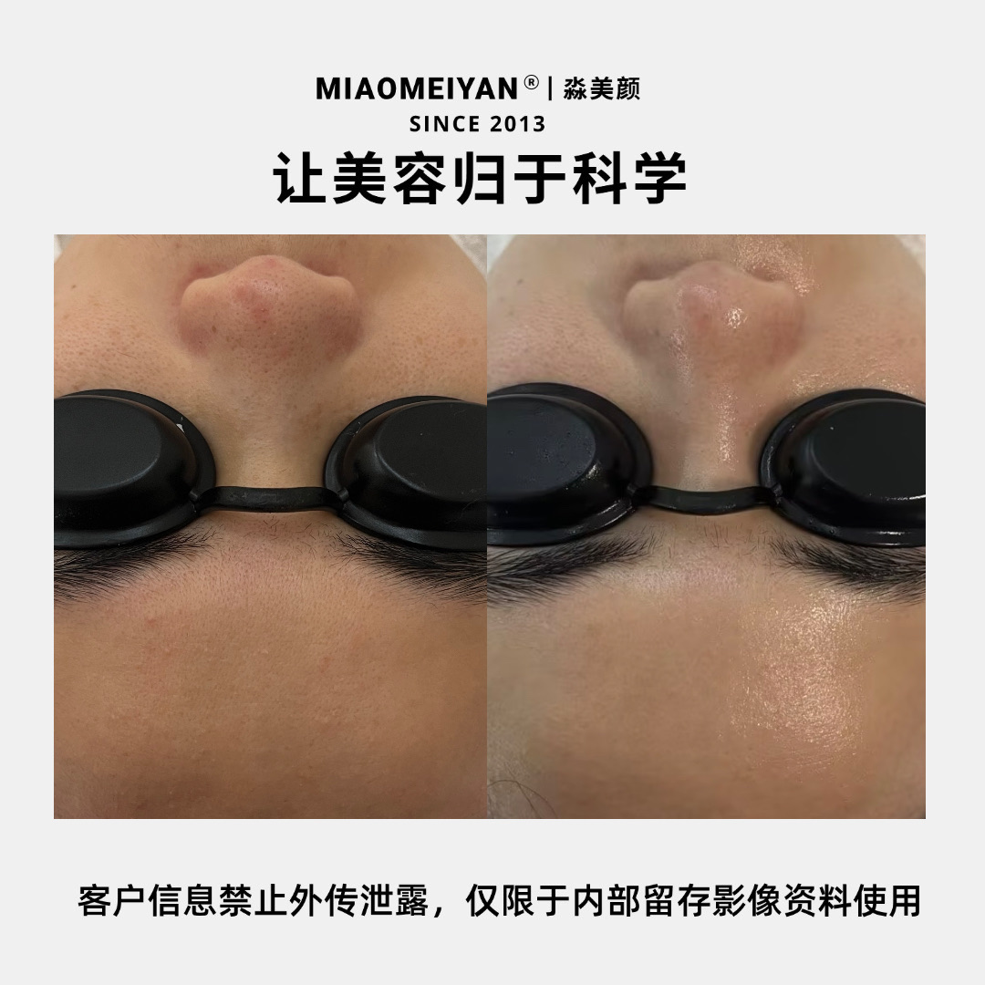 案例3