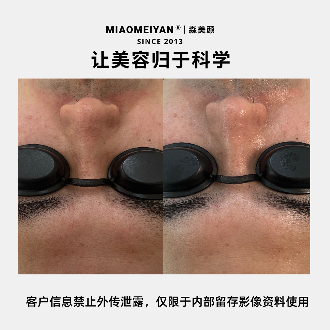 案例2