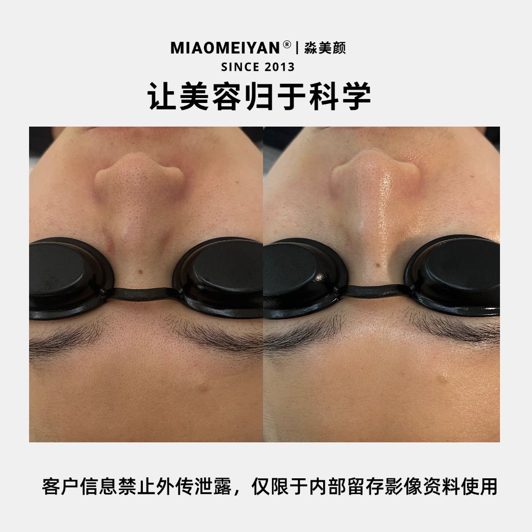 案例3