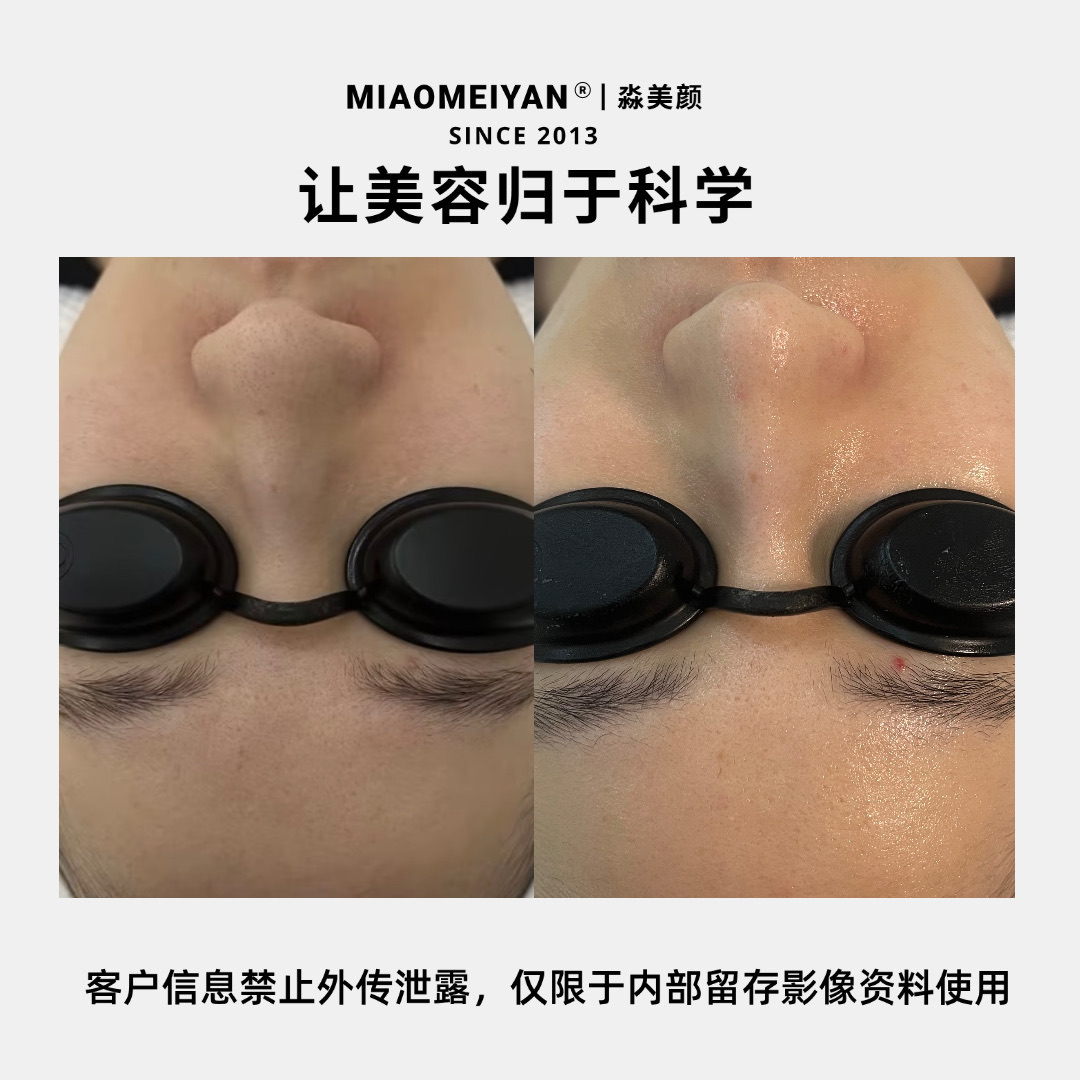 案例1