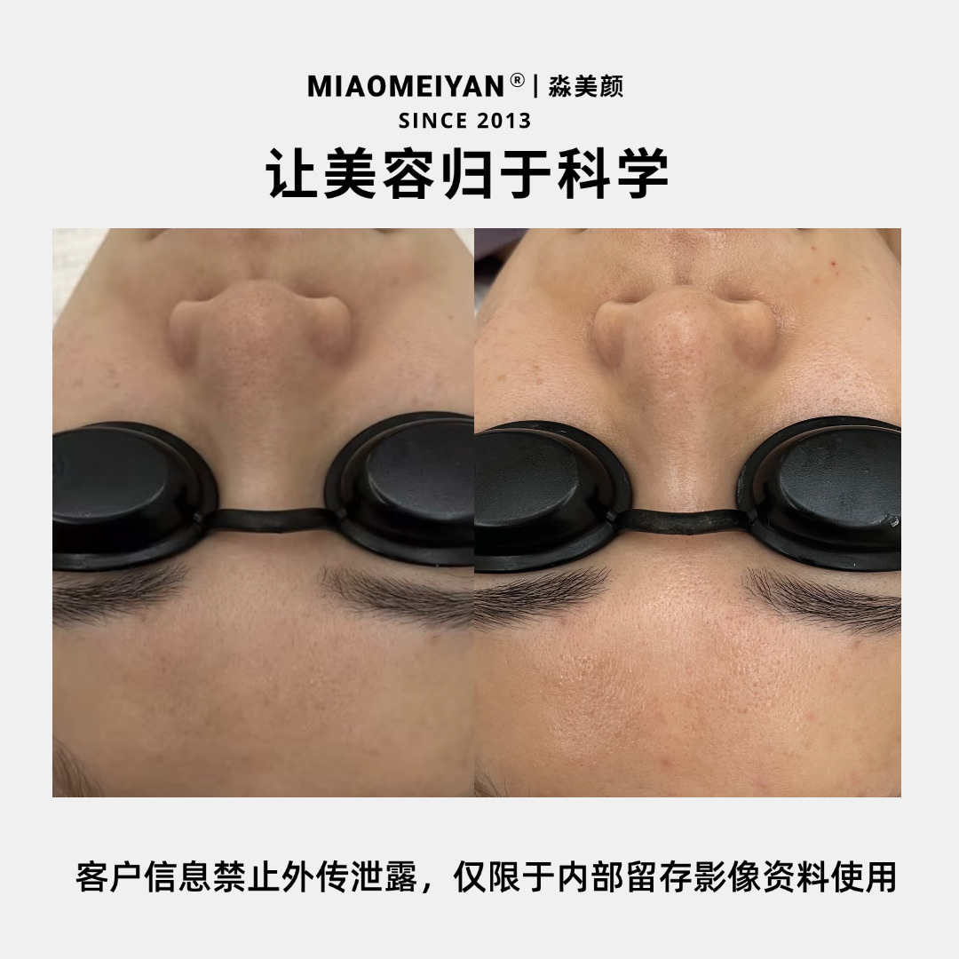 案例2
