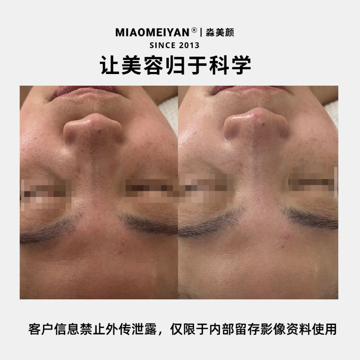 案例3