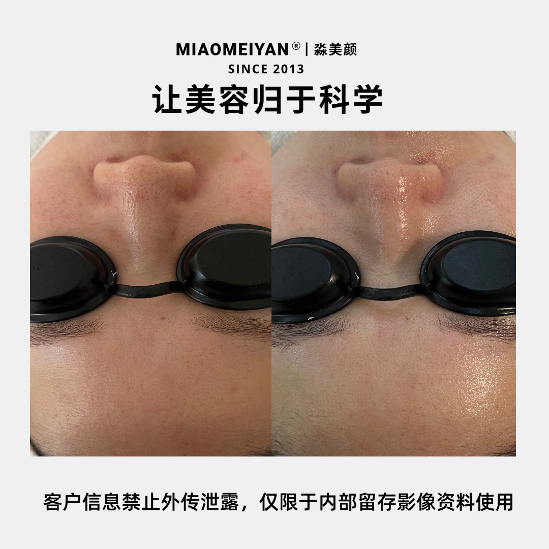 案例1