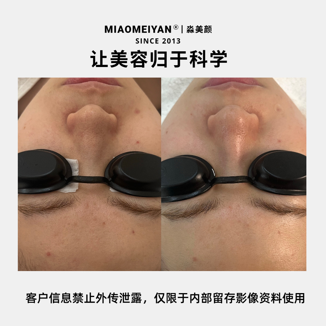 案例2