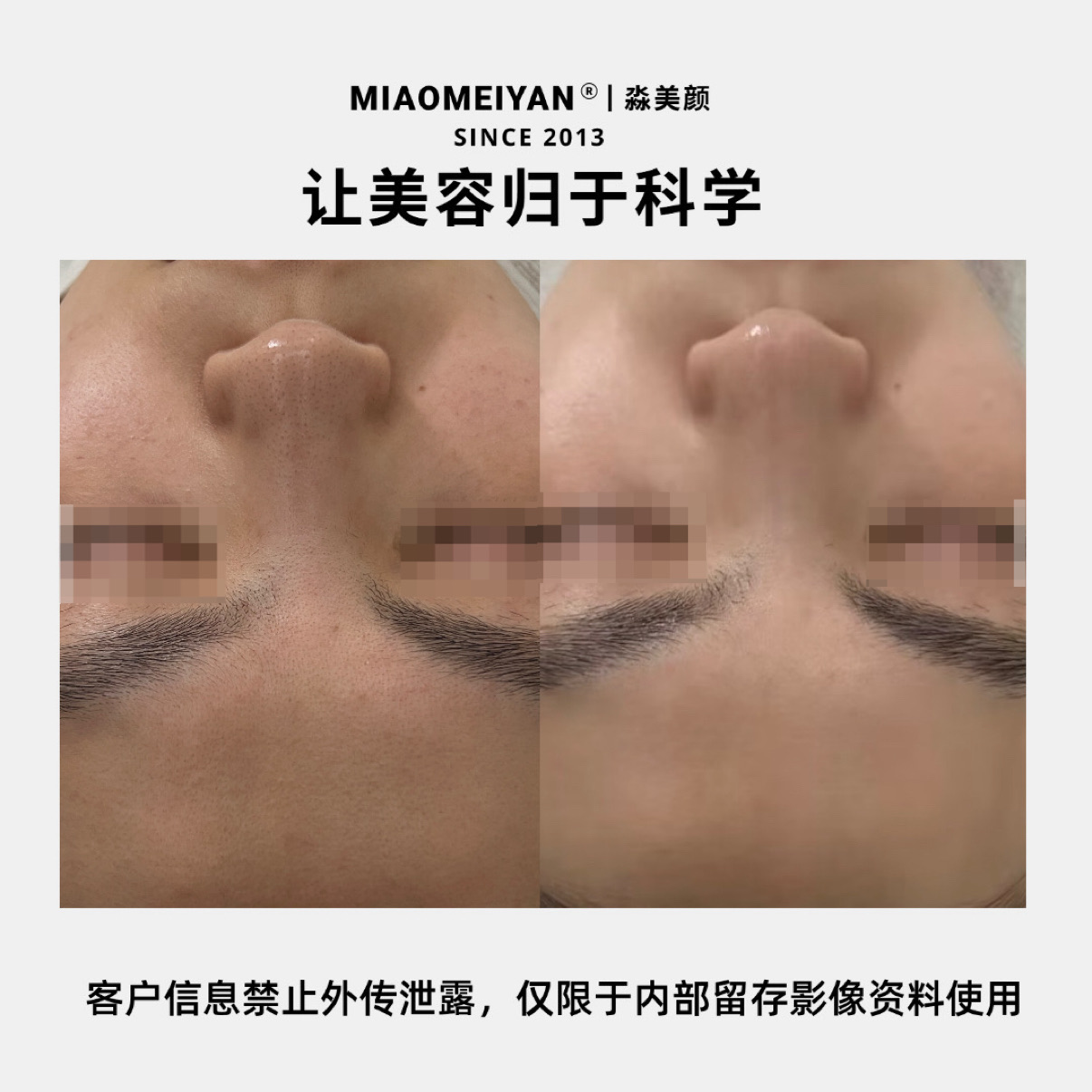 案例3