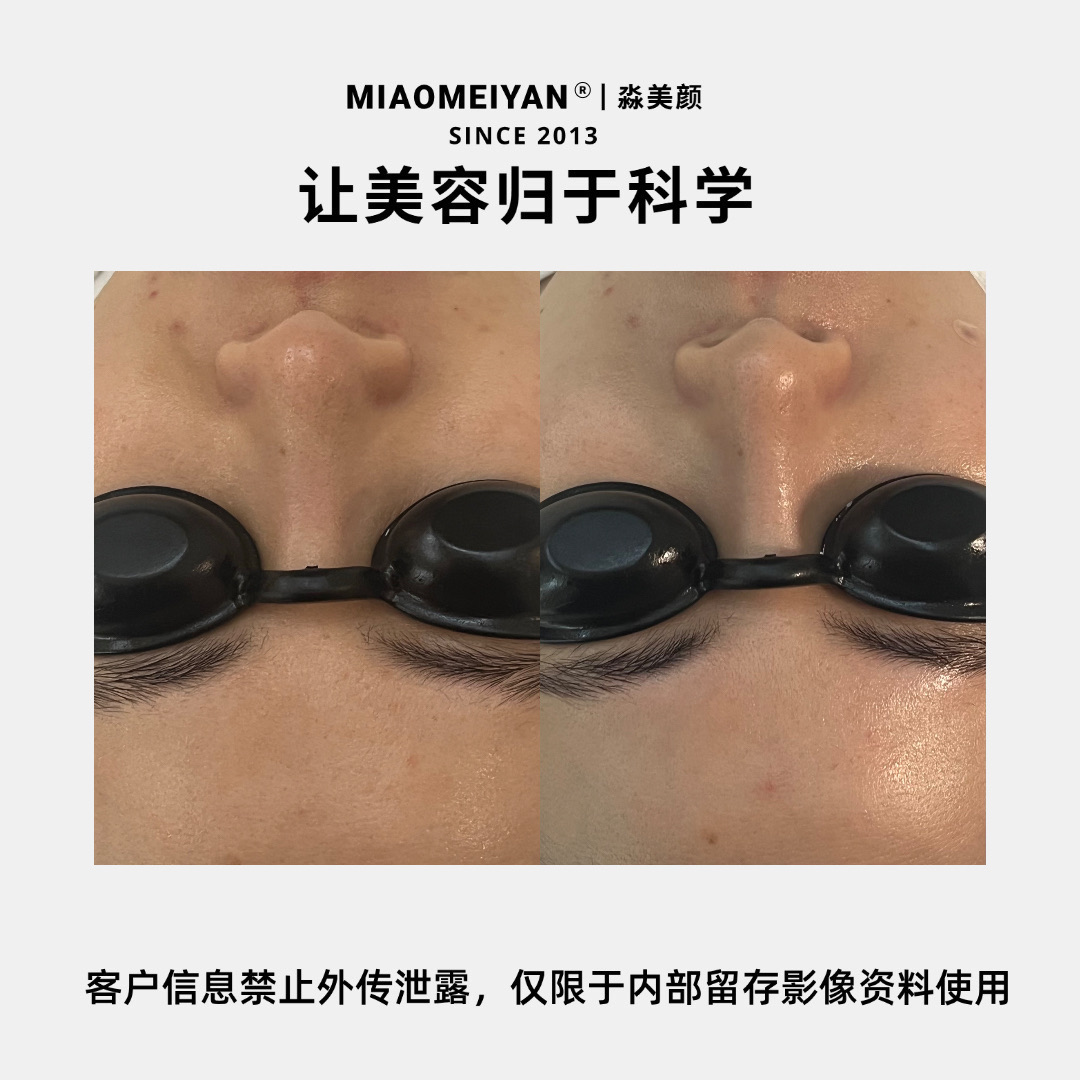 案例1