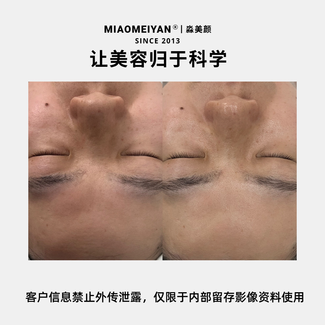 案例2