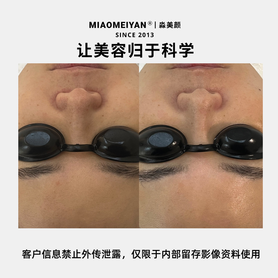 案例3