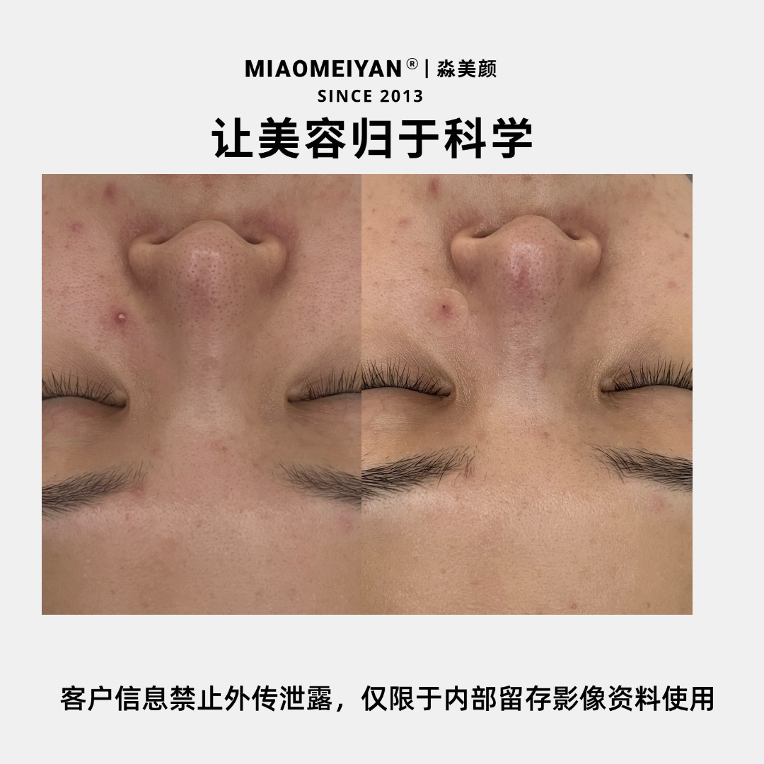 案例1