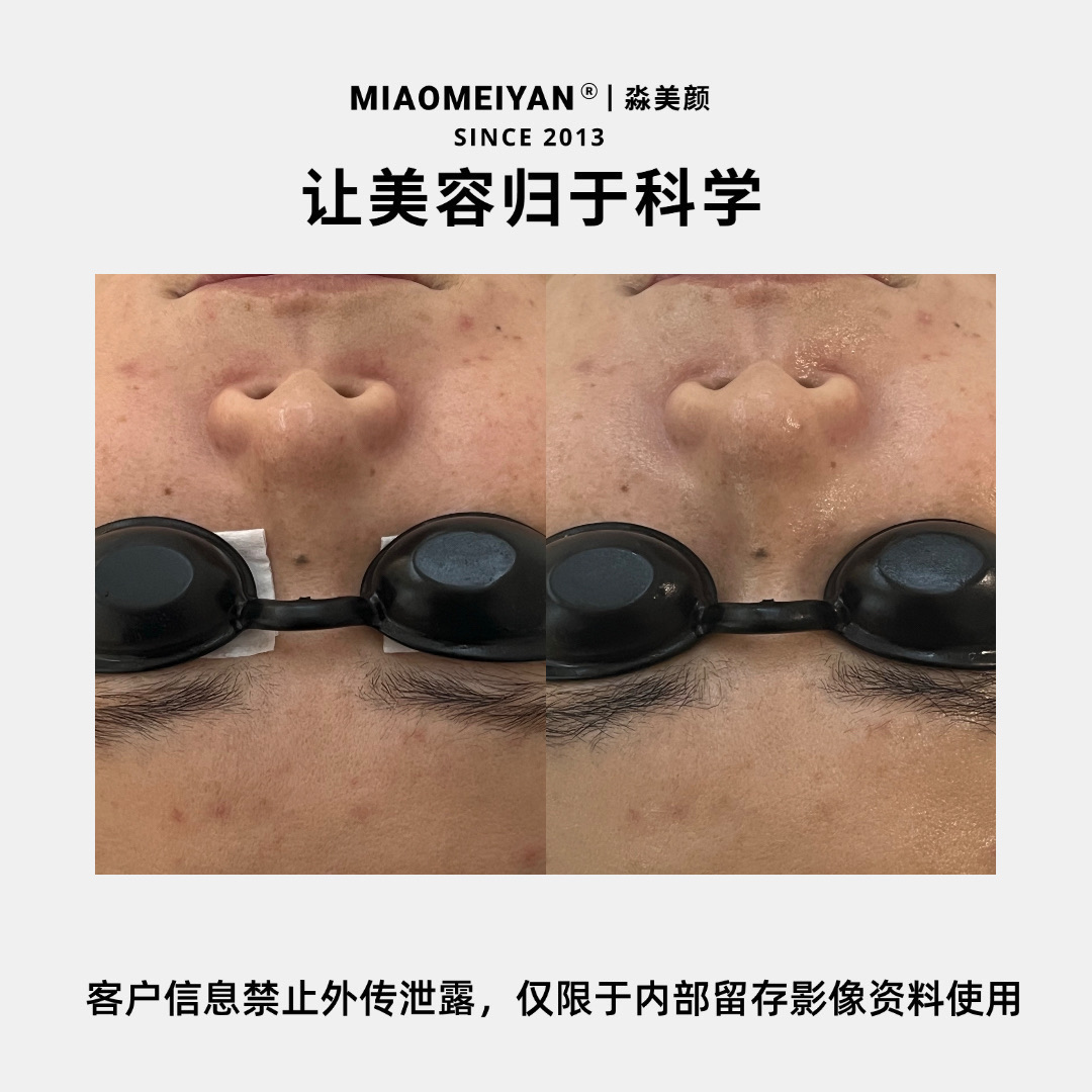 案例2