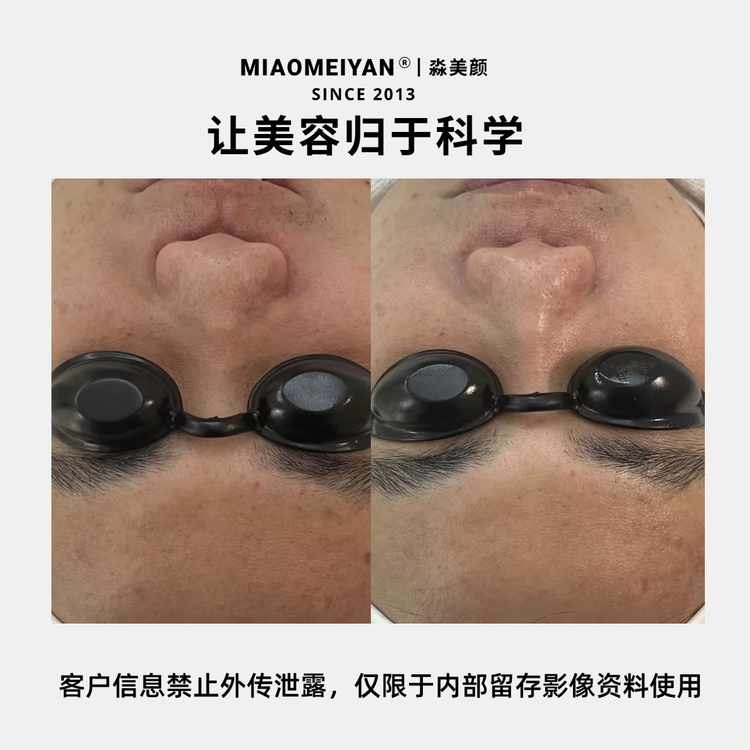 案例3