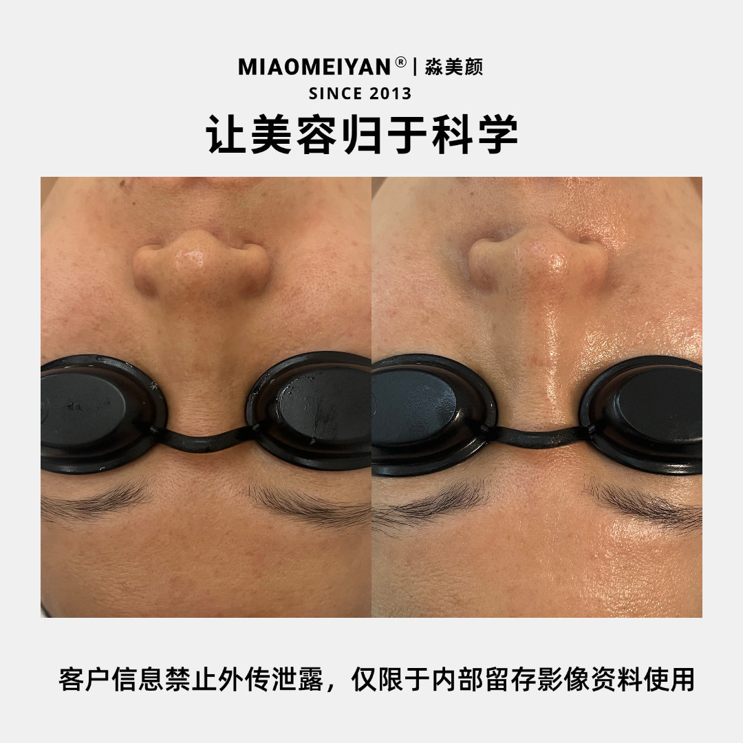 案例1