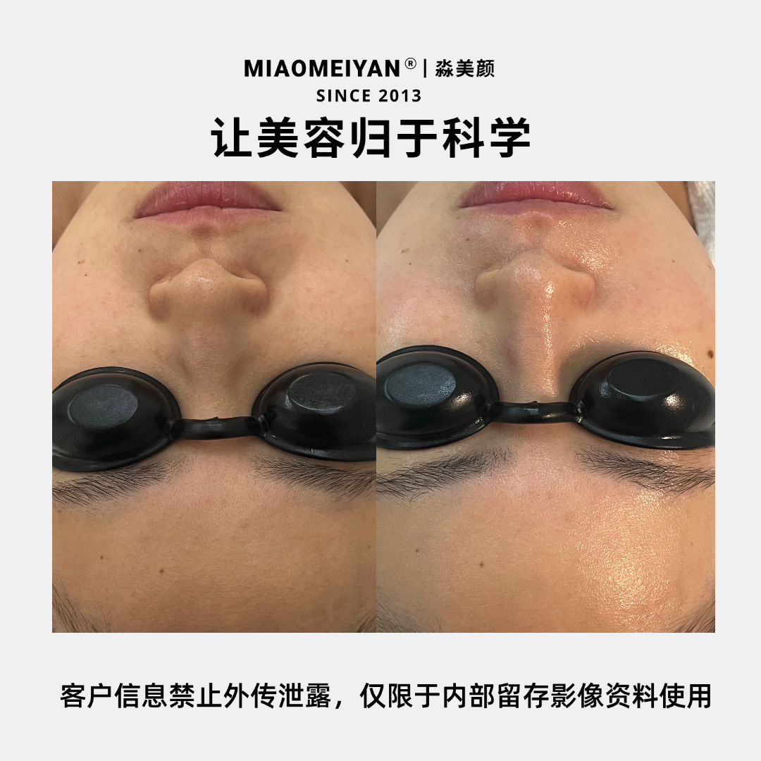 案例3