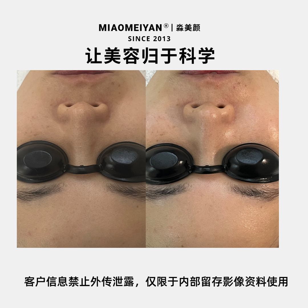 案例1