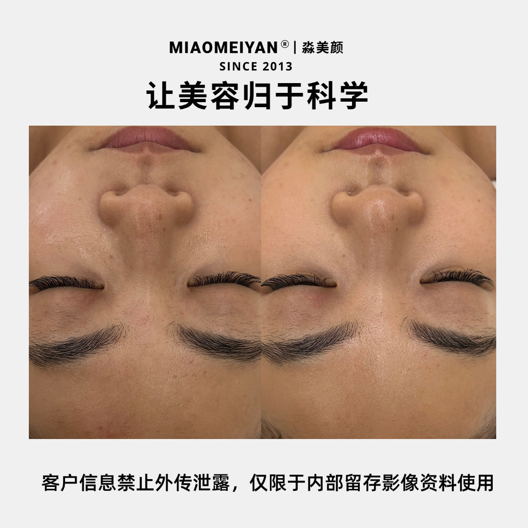 案例2
