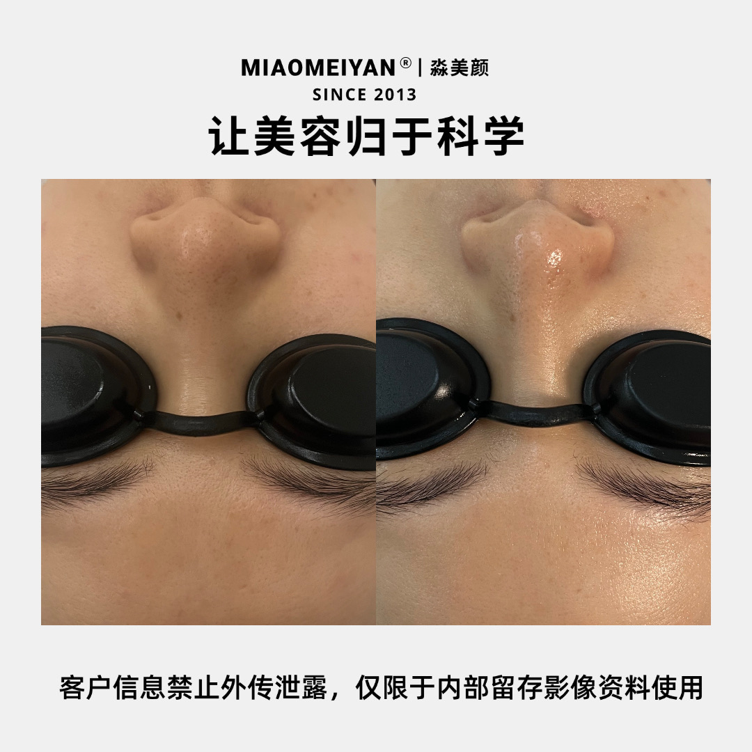 案例3
