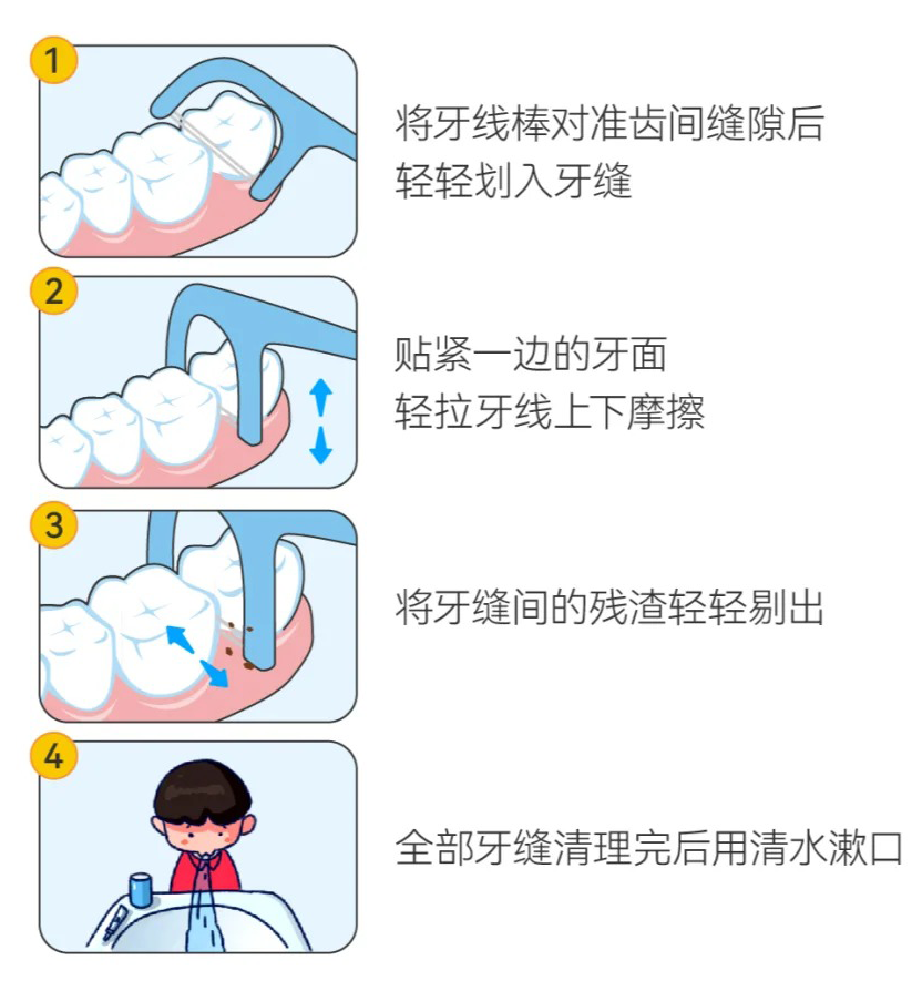 儿童用牙线会伤牙吗？_1_奥乐V_来自小红书网页版.png