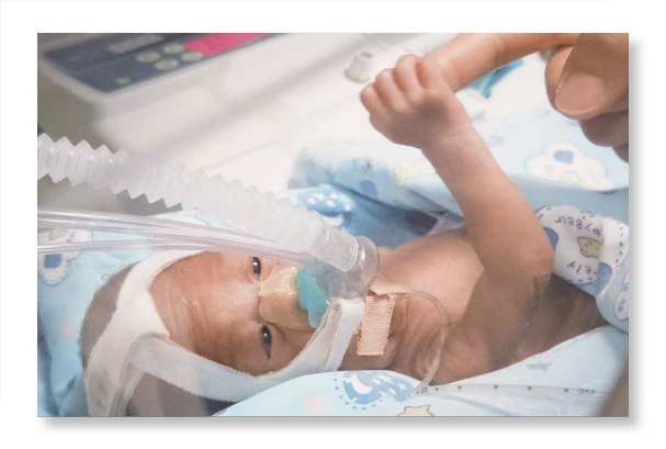 「从未想过放弃！」生死竞速 88 天，西北妇儿成功救下 24 周超早产宝宝