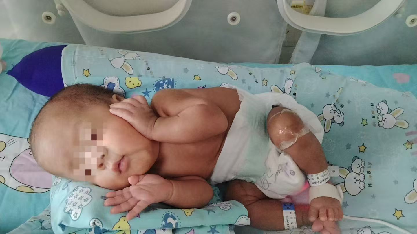 「从未想过放弃！」生死竞速 88 天，西北妇儿成功救下 24 周超早产宝宝