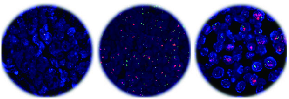 分子病理技术平台